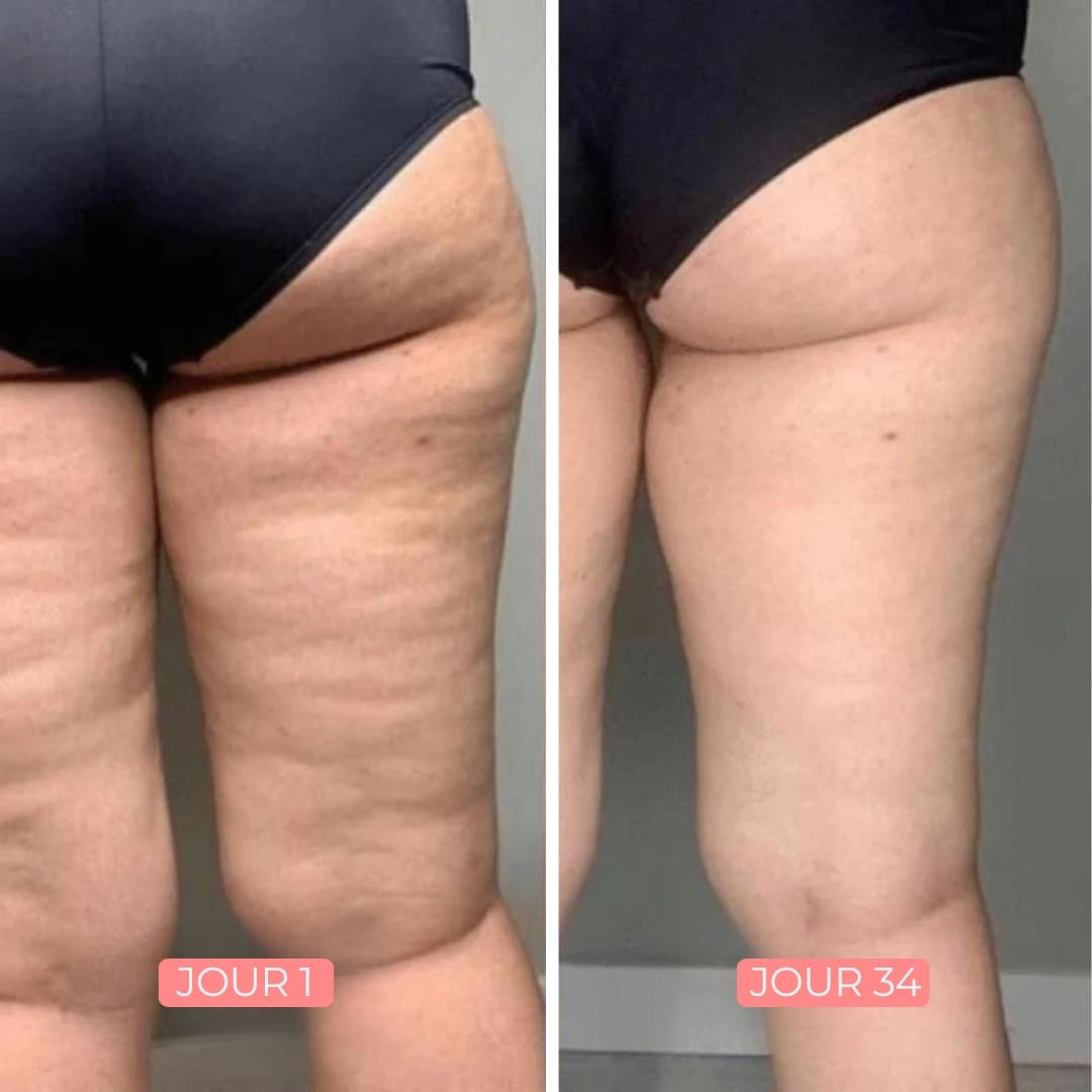 B-Smooth Lift & Firm Booty Cream