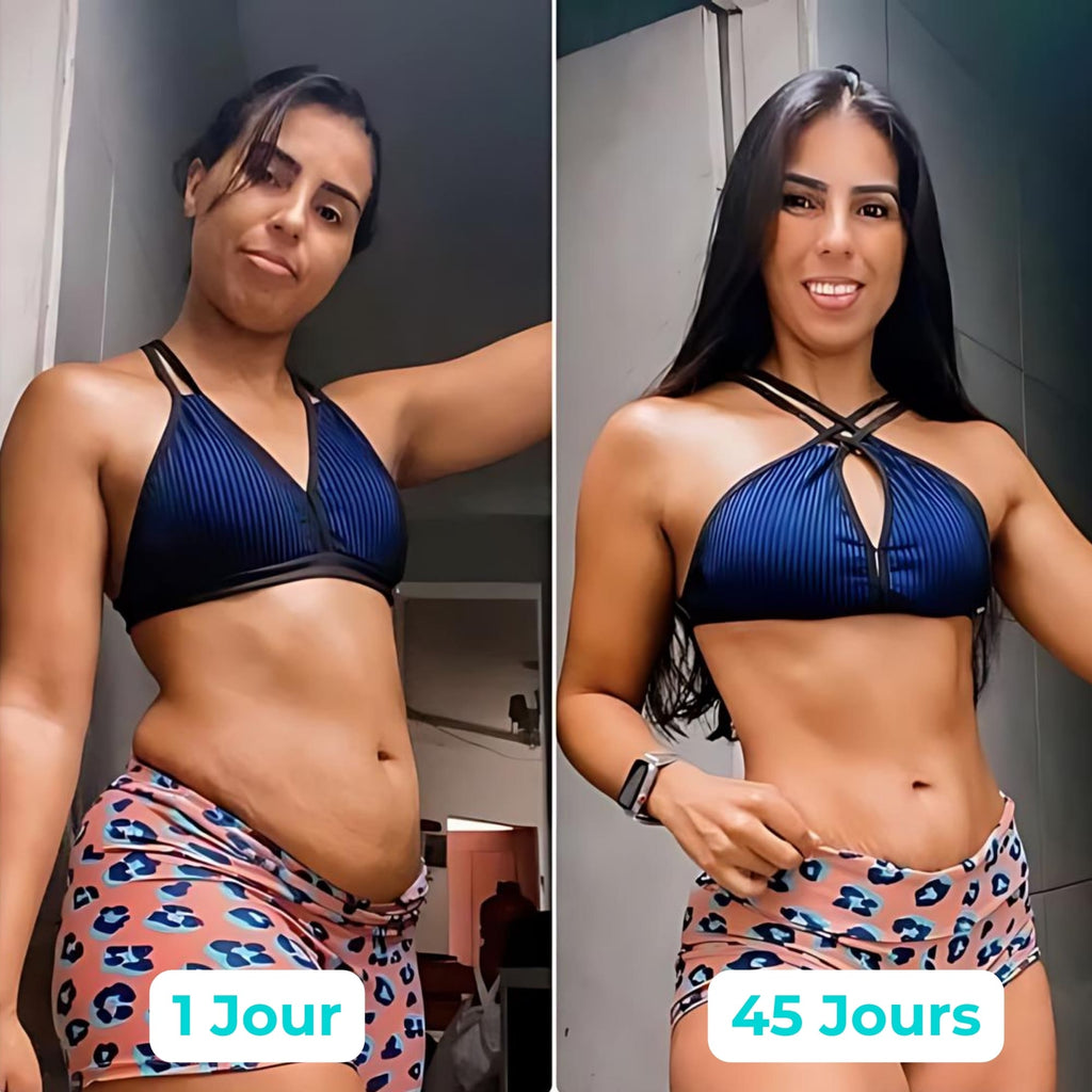 Vibraskin® - Améliore l'apparence de la peau